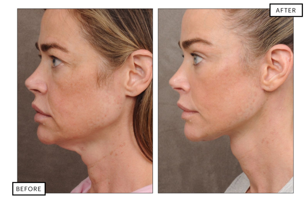 Image may contain Head Person Face Body Part Neck Adult Photography and Portrait